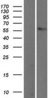 Western Blot: TBX5 Overexpression Lysate (Adult Normal) [NBP2-04153] Left-Empty vector transfected control cell lysate (HEK293 cell lysate); Right -Over-expression Lysate for TBX5.