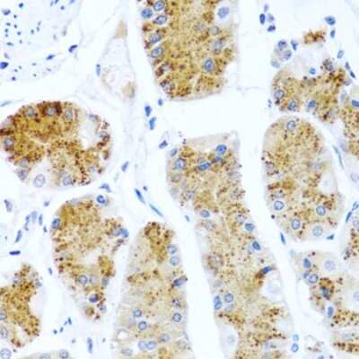 Immunohistochemistry-Paraffin: TC-1 Antibody [NBP2-93727] - Human stomach using C8orf4 antibody at dilution of 1:100 (40x lens).Perform microwave antigen retrieval with 10 mM PBS buffer pH 7.2 before commencing with IHC staining protocol.