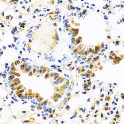 Immunohistochemistry-Paraffin: TC-1 Antibody [NBP2-93727] -  Mouse lung using C8orf4 antibody at dilution of 1:100 (40x lens).Perform microwave antigen retrieval with 10 mM PBS buffer pH 7.2 before commencing with IHC staining protocol.