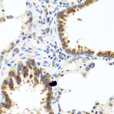 Immunohistochemistry-Paraffin: TC-1 Antibody [NBP2-93727] -  Rat lung using C8orf4 antibody at dilution of 1:100 (40x lens).Perform microwave antigen retrieval with 10 mM PBS buffer pH 7.2 before commencing with IHC staining protocol.