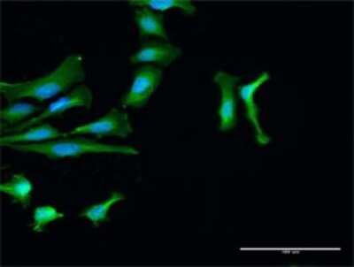 Immunocytochemistry/Immunofluorescence: TC-PTP/PTPN2 Antibody [H00005771-D01P] - Analysis of antibody to PTPN2 on HeLa cell. Antibody concentration 20 ug/ml.