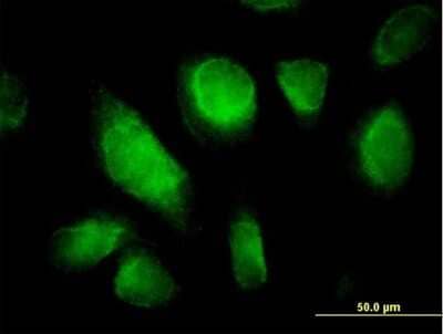 Immunocytochemistry/Immunofluorescence: TC10 Antibody [H00023433-B01P] - Analysis of purified antibody to RHOQ on HeLa cell. (antibody concentration 10 ug/ml)