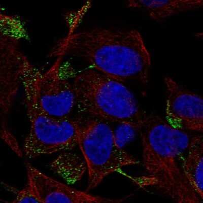 Immunocytochemistry/Immunofluorescence: TC10 Antibody [NBP2-55239] - Staining of human cell line SH-SY5Y shows localization to vesicles.