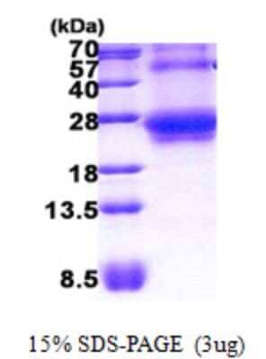 SDS-PAGE Recombinant Human TC10 His Protein