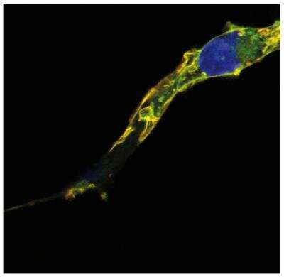 Immunocytochemistry/Immunofluorescence: TC21/R-Ras2 Antibody (EM-50) [NBP2-62216] - Colocalization of R-Ras2/TC21 signal (red) and GFP signal (green) in COS cells transfected with R-Ras2/TC21-GFP construct, after fixation and permeabilization. R-Ras2/TC21 was detected using monoclonal antibody EM-50, purified.