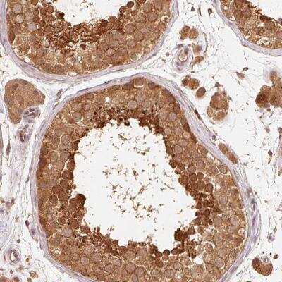 Immunohistochemistry-Paraffin: TC21/R-Ras2 Antibody [NBP2-38639] - Staining of human testis shows strong cytoplasmic positivity in cells in seminiferus ducts.