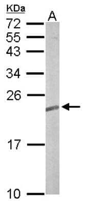 Western Blot: TC21/R-Ras2 Antibody [NBP1-32919] - Sample (50 ug of whole cell lysate) A: mouse brain 12% SDS PAGE; antibody diluted at 1:5000.