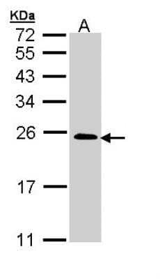 Western Blot TC21/R-Ras2 Antibody - BSA Free
