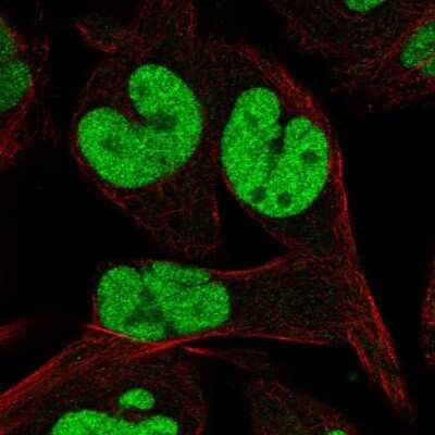 Immunocytochemistry/Immunofluorescence: TCEAL1 Antibody [NBP2-68762] - Staining of human cell line RH-30 shows localization to nucleoplasm.