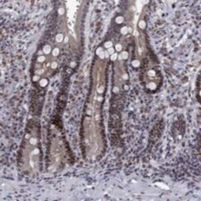 Immunohistochemistry-Paraffin: TCEAL1 Antibody [NBP3-17943] - Staining of human duodenum shows moderate nuclear positivity in glandular cells.