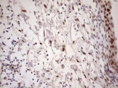 Immunohistochemistry: TCEAL1 Antibody (OTI2G10) - Azide and BSA Free [NBP2-74472] - Analysis of Human bladder tissue. (Heat-induced epitope retrieval by 1mM EDTA in 10mM Tris buffer (pH8.5) at 120C for 3 min)