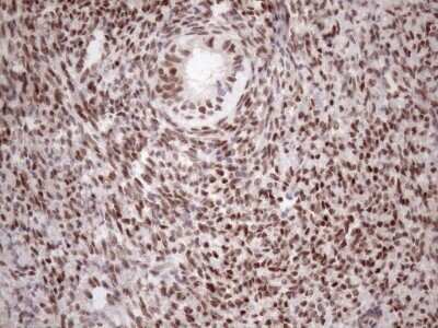 Immunohistochemistry: TCEAL1 Antibody (OTI2G10) - Azide and BSA Free [NBP2-74472] - Analysis of Human endometrium. (Heat-induced epitope retrieval by 1mM EDTA in 10mM Tris buffer (pH8.5) at 120C for 3 min)