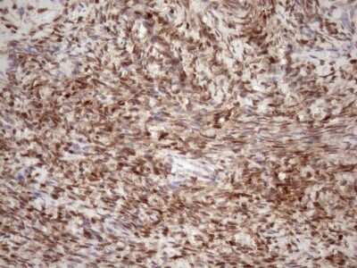 Immunohistochemistry: TCEAL1 Antibody (OTI2G10) - Azide and BSA Free [NBP2-74472] - Analysis of Human Ovary tissue. (Heat-induced epitope retrieval by 1mM EDTA in 10mM Tris buffer (pH8.5) at 120C for 3 min)