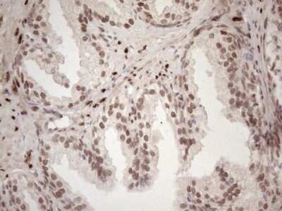 Immunohistochemistry: TCEAL1 Antibody (OTI2G10) - Azide and BSA Free [NBP2-74472] - Analysis of Human prostate tissue. (Heat-induced epitope retrieval by 1mM EDTA in 10mM Tris buffer (pH8.5) at 120C for 3 min)