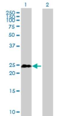 Western Blot: TCEAL1 Antibody [H00009338-B01P] - Analysis of TCEAL1 expression in transfected 293T cell line by TCEAL1 polyclonal antibody.  Lane 1: TCEAL1 transfected lysate(17.49 KDa). Lane 2: Non-transfected lysate.