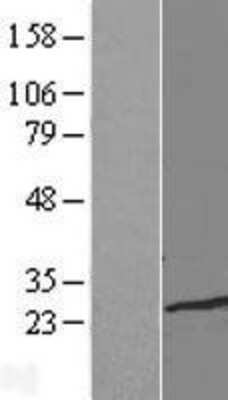 Western Blot: TCEAL1 Overexpression Lysate (Adult Normal) [NBP2-08829] Left-Empty vector transfected control cell lysate (HEK293 cell lysate); Right -Over-expression Lysate for TCEAL1.