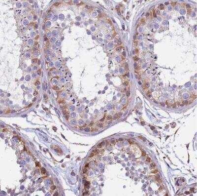 Immunohistochemistry-Paraffin TCEAL5 Antibody - BSA Free