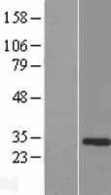 Western Blot: TCEAL5 Overexpression Lysate (Adult Normal) [NBP2-08712] Left-Empty vector transfected control cell lysate (HEK293 cell lysate); Right -Over-expression Lysate for TCEAL5.
