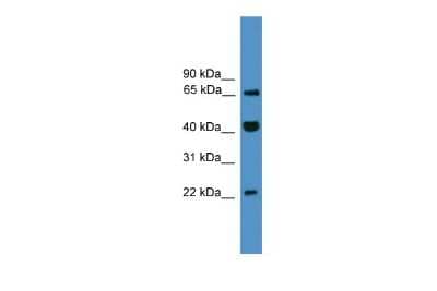 Western Blot TCEAL6 Antibody - BSA Free