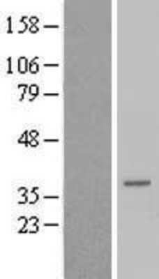 Western Blot: TCEAL6 Overexpression Lysate (Adult Normal) [NBP2-08836] Left-Empty vector transfected control cell lysate (HEK293 cell lysate); Right -Over-expression Lysate for TCEAL6.