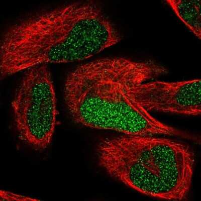 Immunocytochemistry/Immunofluorescence: TCEAL7 Antibody [NBP2-56168] - Staining of human cell line RH-30 shows localization to nucleus.