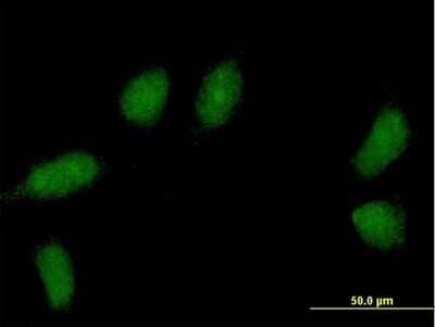 Immunocytochemistry/Immunofluorescence: TCEANC2 Antibody [H00127428-B01P] - Analysis of purified antibody to C1orf83 on HeLa cell. (antibody concentration 10 ug/ml)