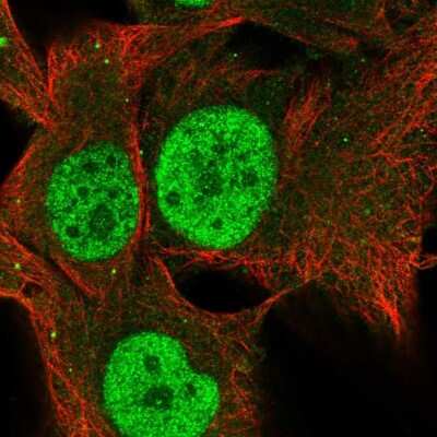 Immunocytochemistry/ Immunofluorescence TCEANC2 Antibody