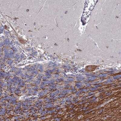 Immunohistochemistry-Paraffin TCEANC2 Antibody