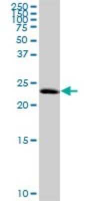 Western Blot: TCEANC2 Antibody [H00127428-B01P] - Analysis of C1orf83 expression in Jurkat.