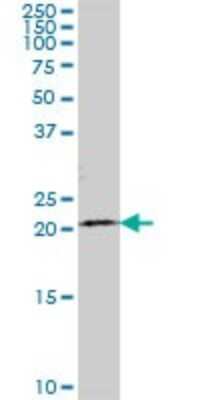 Western Blot TCEANC2 Antibody