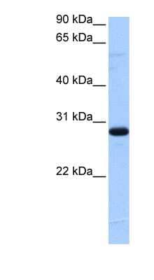 Western Blot TCEANC2 Antibody