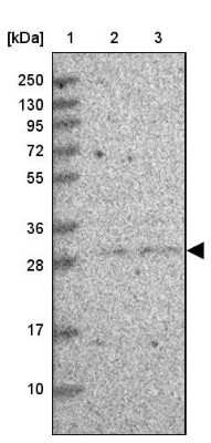 Western Blot TCEANC2 Antibody