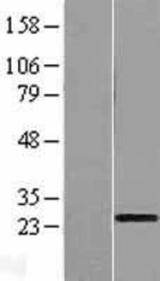 Western Blot TCEANC2 Overexpression Lysate