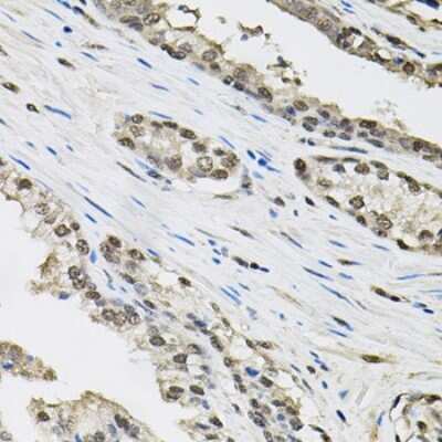 Immunohistochemistry-Paraffin: TCEB1 Antibody [NBP2-93682] - Human prostate using TCEB1 antibody (40x lens).