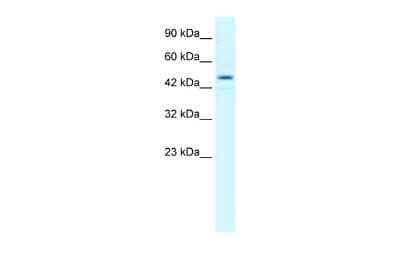 Western Blot: TCEB1 Antibody [NBP2-83628] - WB Suggested Anti-TCEB1 Antibody Titration: 1.0ug/ml. Positive Control: Jurkat cell lysateTCEB1 is supported by BioGPS gene expression data to be expressed in Jurkat