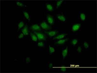 Immunocytochemistry/Immunofluorescence: TCEB2 Antibody (6F6) [H00006923-M01] - Analysis of monoclonal antibody to TCEB2 on HeLa cell. Antibody concentration 10 ug/ml.