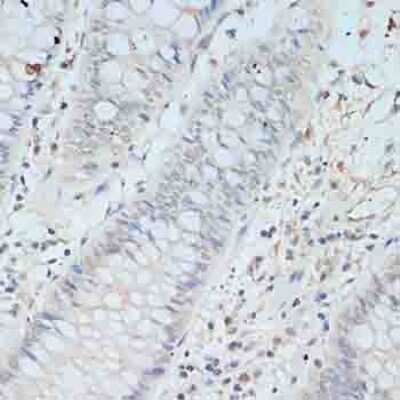 Immunohistochemistry-Paraffin: TCEB2 Antibody [NBP2-94034] - Paraffin-embedded human colon using TCEB2 .