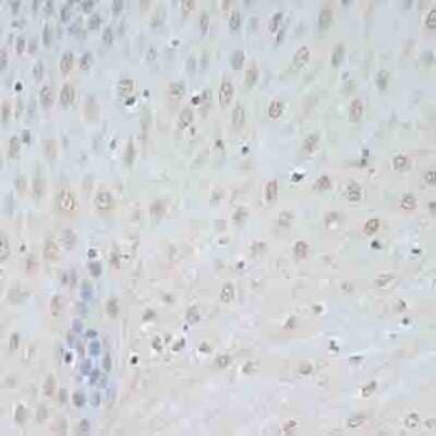 Immunohistochemistry-Paraffin: TCEB2 Antibody [NBP2-94034] - Paraffin-embedded human esophagus using TCEB2 .