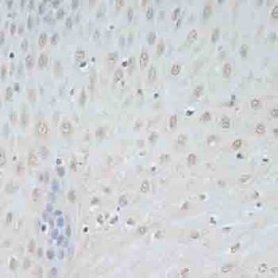 Immunohistochemistry-Paraffin: TCEB2 Antibody [NBP2-94034] - Paraffin-embedded human esophagus using TCEB2 .