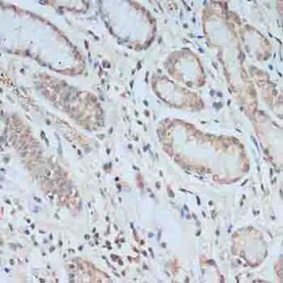 Immunohistochemistry-Paraffin: TCEB2 Antibody [NBP2-94034] - Paraffin-embedded human stomach using TCEB2 .