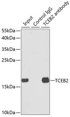 Immunohistochemistry-Paraffin: TCEB2 Antibody [NBP2-94149] - Analysis of 150ug extracts of MCF7 cells using TCEB2 at a dilition of 1:500.