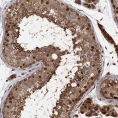 Immunohistochemistry-Paraffin: TCEB2 Antibody [NBP3-17944] - Staining of human testis shows strong nuclear and cytoplasmic positivity in cells in seminiferous ducts and Leydig cells.