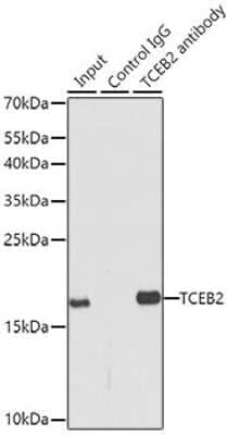 Immunoprecipitation: TCEB2 Antibody [NBP2-94034] - Analysis of 150ug extracts of MCF7 cells using TCEB2 at a dilition of 1:500.