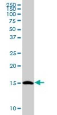 Western Blot: TCEB2 Antibody [H00006923-B01P] - Analysis of TCEB2 expression in Jurkat.