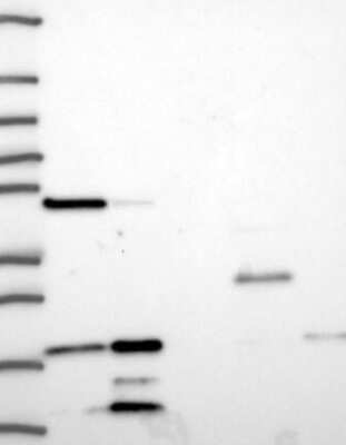 Western Blot: TCEB2 Antibody [NBP3-17944] - Lane 1: Marker [kDa] 250, 130, 95, 72, 55, 36, 28, 17, 10;   Lane 2: RT4;   Lane 3: U-251 MG;   Lane 4: Human Plasma;   Lane 5: Liver;   Lane 6: Tonsil