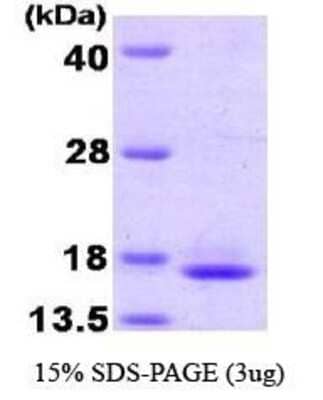SDS-PAGE Recombinant Human TCEB2 Protein