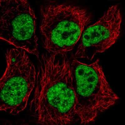 Immunocytochemistry/Immunofluorescence: TCERG1 Antibody [NBP2-55769] - Staining of human cell line HaCaT shows localization to nucleoplasm.