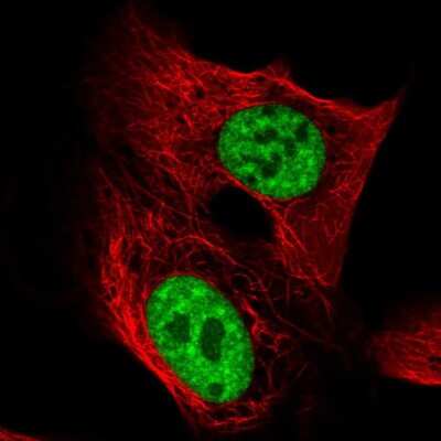 Immunocytochemistry/Immunofluorescence: TCERG1 Antibody [NBP2-57767] - Staining of human cell line U-2 OS shows localization to nucleoplasm.