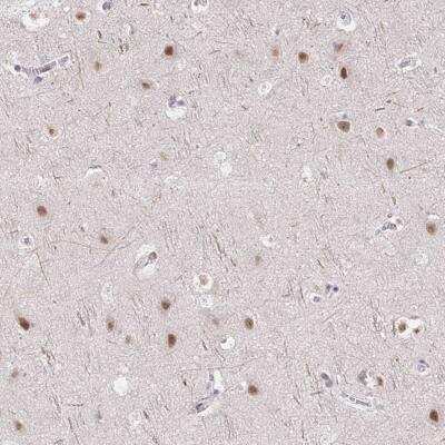Immunohistochemistry-Paraffin: TCERG1 Antibody [NBP2-39037] - Staining of human cerebral cortex shows moderate nuclear positivity in neuronal cells.