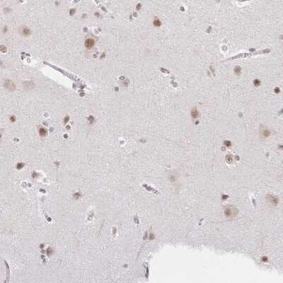 Immunohistochemistry-Paraffin: TCERG1 Antibody [NBP2-39037] - Staining of human cerebral cortex shows high expression.